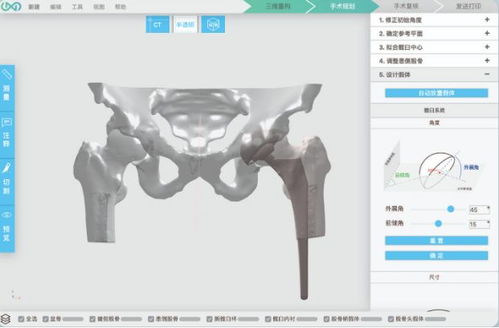 3d打印人體骨骼 這家哈佛大學(xué)孵化的公司要為中國醫(yī)生開發(fā)自己的軟件平臺(tái)...